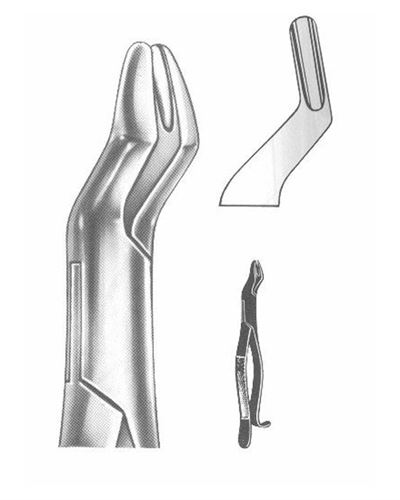 Upper Molars